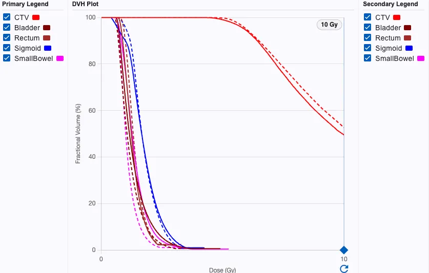 Dose–volume histogram of the optimized plan for CTV and OARs